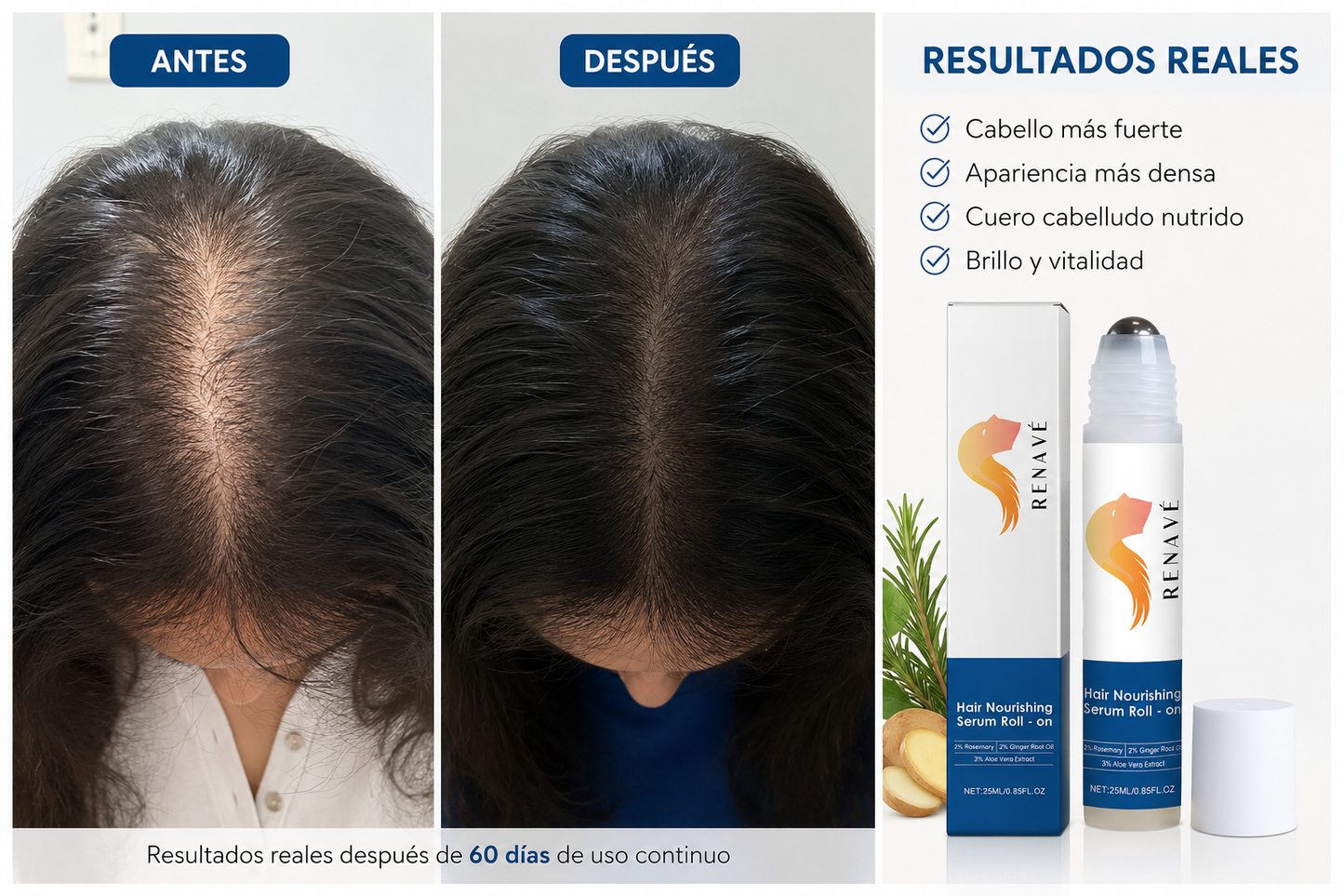 SERUM ROLL-ON PARA EL CRECIMIENTO CAPILAR